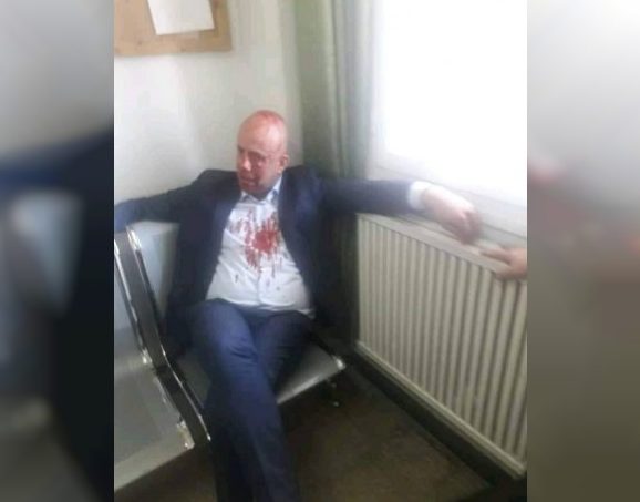 صورة رئيس نادي جزائري لكرة القدم يتعرض للطعن بالسلاح الأبيض