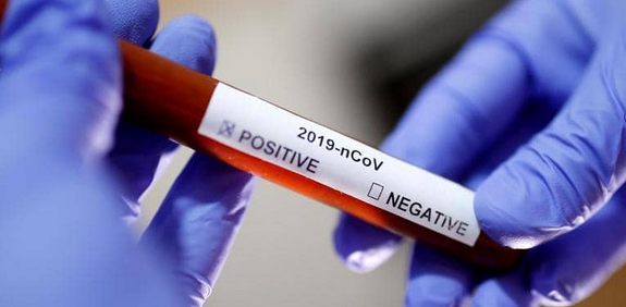 صورة وزارة الصحة تكشف سبب ارتفاع نسبة الوفيات بكورونا فيروس