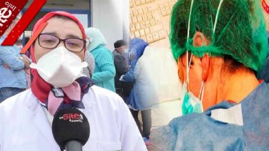 صورة الاعتداء على ممرضة وكسر أنفها يُخرج أطباء ومهنيين للاحتجاج بـ”كازا” -فيديو