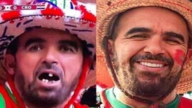 صورة طبيب أردني يشرف على ابتسامة مشجع مغربي تعرض للتنمر في مونديال قطر