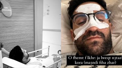 صورة سيمو سدراتي يصاب على مستوى الوجه و”يعتزل” كرة القدم